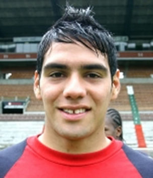 Radamel Falcao smiling and showing a big empty space between his teeth, as if he missed a front tooth