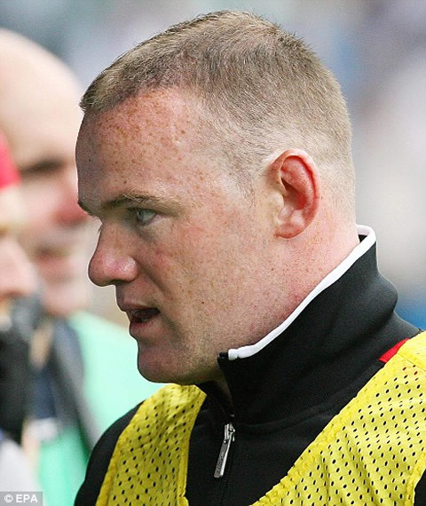 Wayne Rooney grey hair, 2 months after the surgery and hair implantation/transplantation