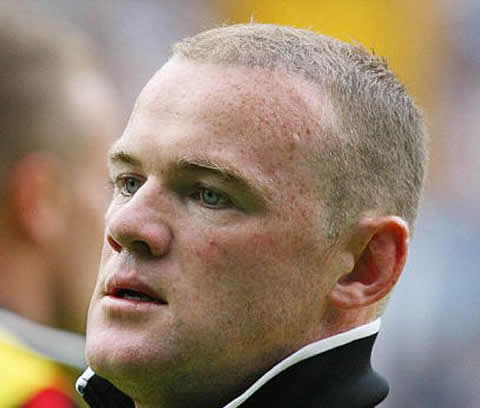 Wayne Rooney new hair turned grey after the hair transplantation and surgery made a few months before