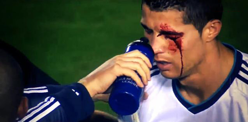 Cristiano Ronaldo bleeding from his eye, after being hit by an elbow in Levante vs Real Madrid for La Liga 2012-2013