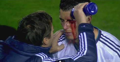 Cristiano Ronaldo spilling water on his wound near his eye, to clean the blood that was covering his face after getting injured from an elbow in Levante vs Real Madrid, for La Liga 2012-2013