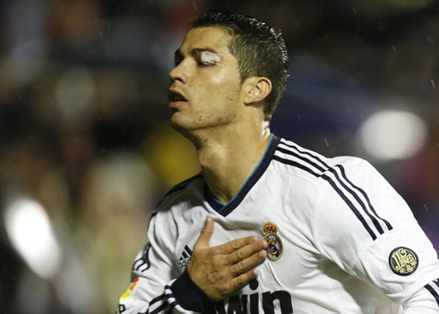 Cristiano Ronaldo left eye patched, just after he scored the opener in Levante 1-2 Real Madrid, for the Spanish League 2012-2013