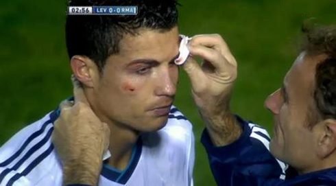 Cristiano Ronaldo being treated and cleaned from the blood draining from his eyebrow, after taking an elbow from David Navarro, in Levante vs Real Madrid in 2012