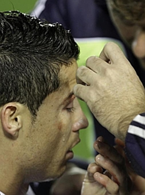 Cristiano Ronaldo being examined on the pitch, after suffering a big blow from an elbow by David Navarro, in Levante 1-2 Real Madrid, in 2012-2013