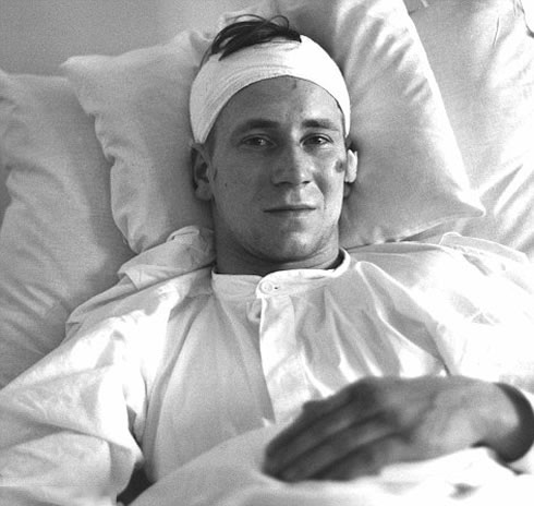 Bobby Charlton injured and lying in the hospital bed, after the Munich air disaster, that victimized the Busby Babes in 1957