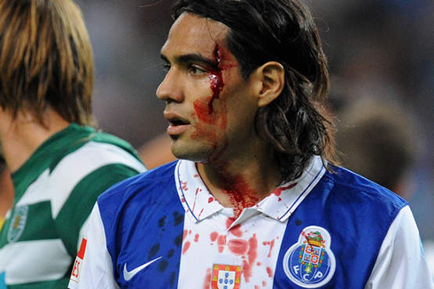 Radamel Falcao bleeding out from a nasty cut above his eyebrow, during a game between FC Porto and Sporting