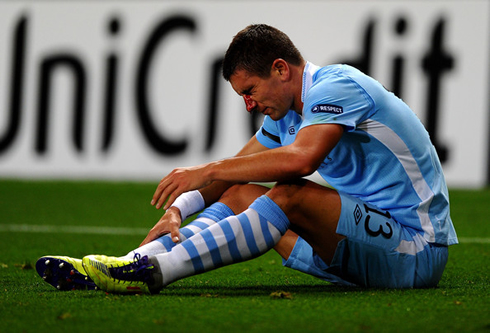 Kolarov, soccer player bleeding from his nose, during a game for Man City