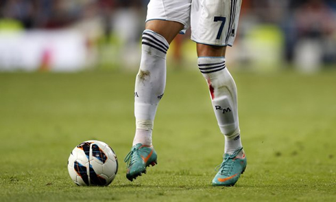 Cristiano Ronaldo bleeding from his left leg, during a Real Madrid game in 2012-2013