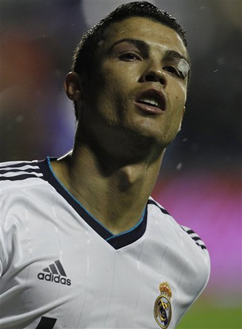 Cristiano Ronaldo face in a wreck, after taking an elbow on his eye and making a big cut on his left eyebrow, in Levante vs Real Madrid, in 2012