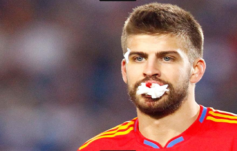 Gerard Piqué ugly face bleeding from his mouth, after losing a tooth during a soccer game