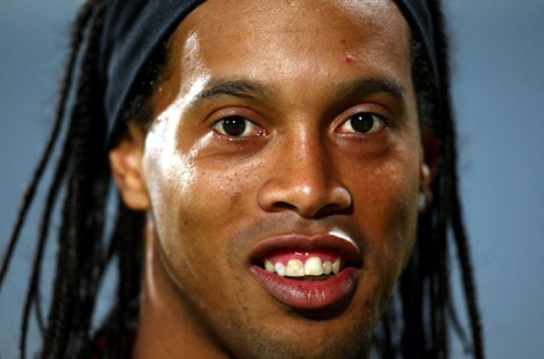 Ronaldinho big teeth and ugly face