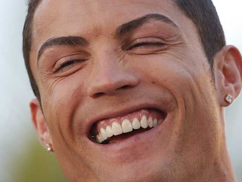 Cristiano Ronaldo smile and teeth