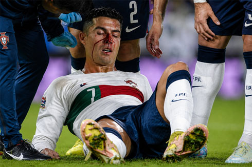 Cristiano Ronaldo down and injured