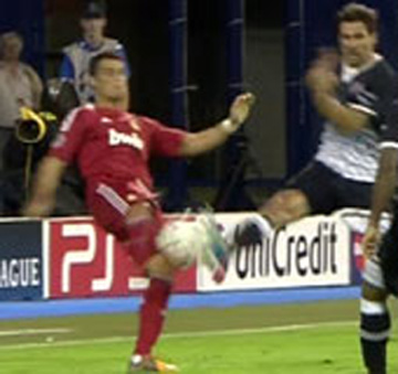 Cristiano Ronaldo hard and brutal tackle on his ankle (resulting in blood), in Dinamo Zagreb vs Real Madrid, for the UEFA Champions League