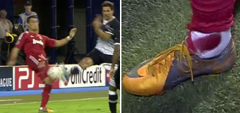 Cristiano Ronaldo tackled and fouled against Dinamo Zagreb and his ankle bleeding, shown from his sock with a big blood stain