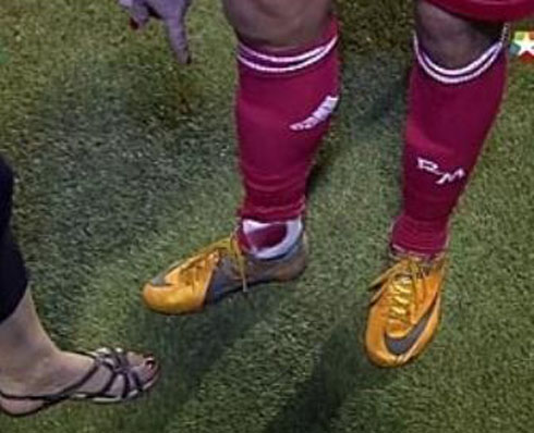 Cristiano Ronaldo showing his ankle injury in blood to the reporters, after the match Dinamo Zagreb vs Real Madrid